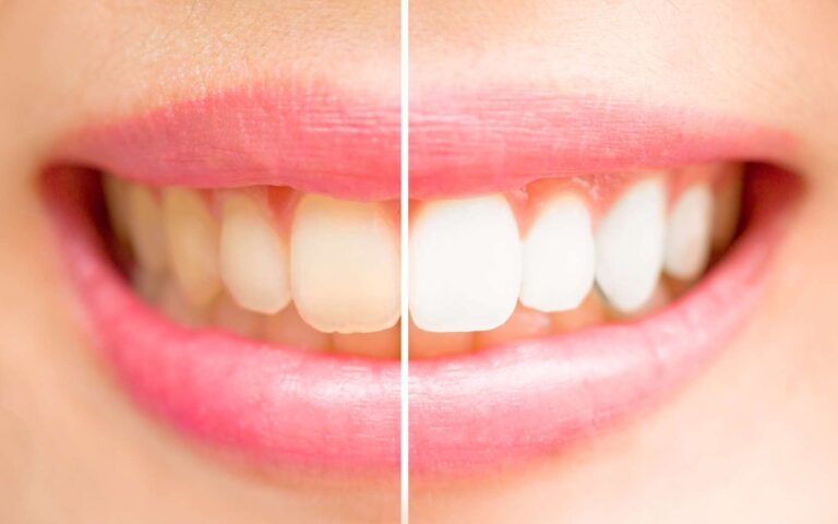 Recette de dentifrice maison 100% naturel