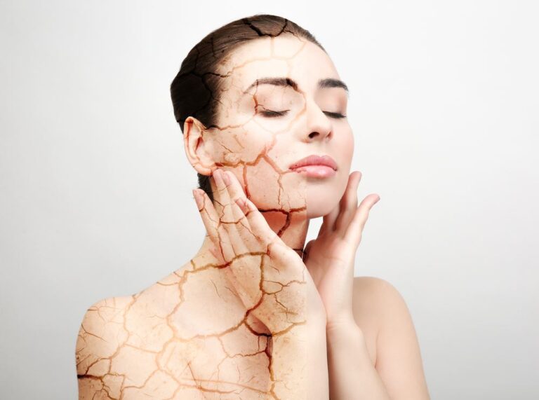 Comment entretenir une peau sèche  ?