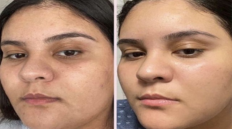 Soin visage : (re)découvrez les surprenants pouvoirs de la rose sur la peau du visage