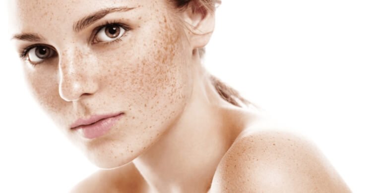 Masque de grossesse : comment éliminer les taches sombres sur le visage?