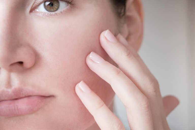 Imperfections De La Peau : Découvrez Nos 10 Soins Naturels.