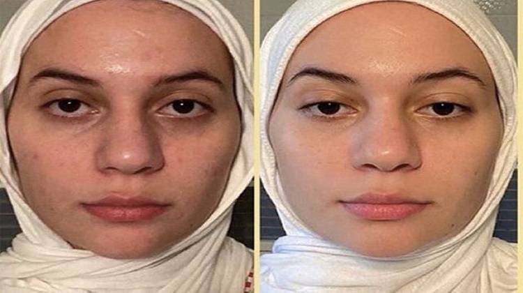 5 gommages pour le visage qui font des miracles sur la peau