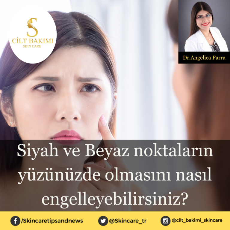 Siyah ve Beyaz noktaların yüzünüzde olmasını nasıl engelleyebilirsiniz?