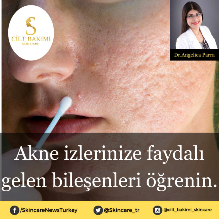 Akne izlerinize faydalı gelen bileşenleri öğrenin.