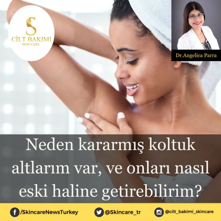 Neden kararmış koltuk altlarım var, ve onları nasıl eski haline getirebilirim?