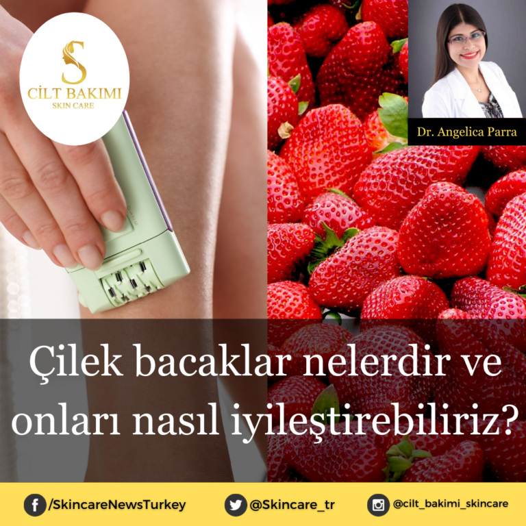Çilek bacaklar nelerdir ve onları nasıl iyileştirebiliriz?