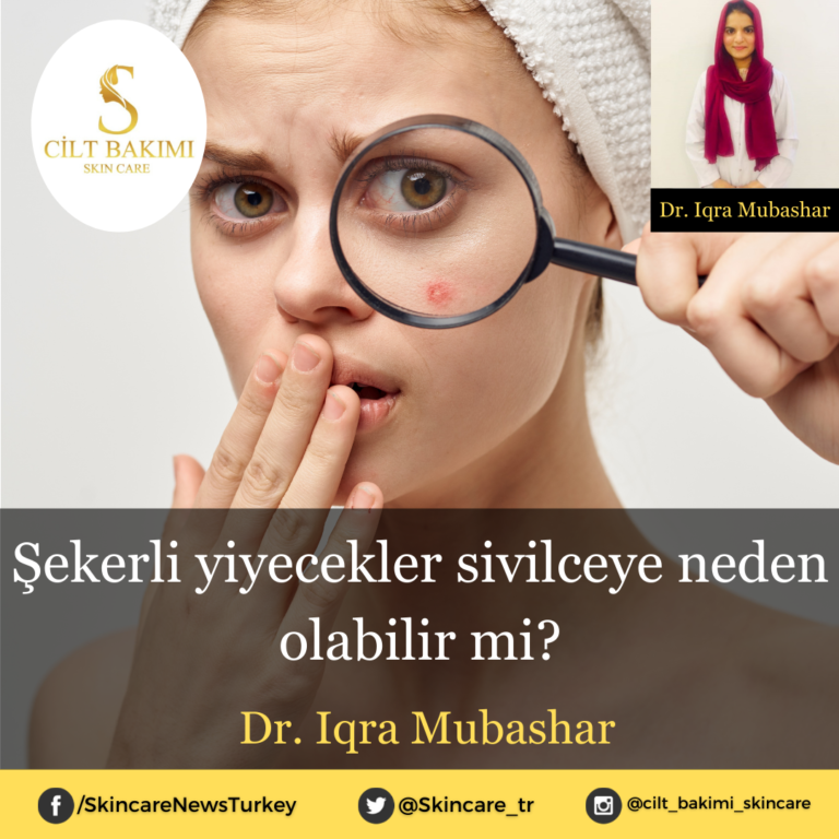 Şekerli yiyecekler sivilceye neden olabilir mi?
