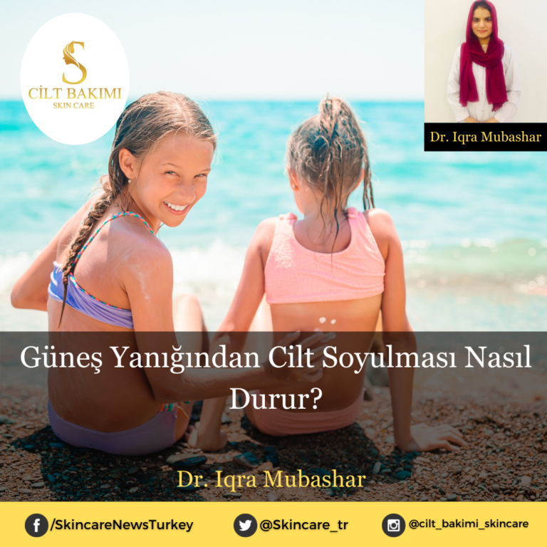 Güneş Yanığından Cilt Soyulması Nasıl Durur?