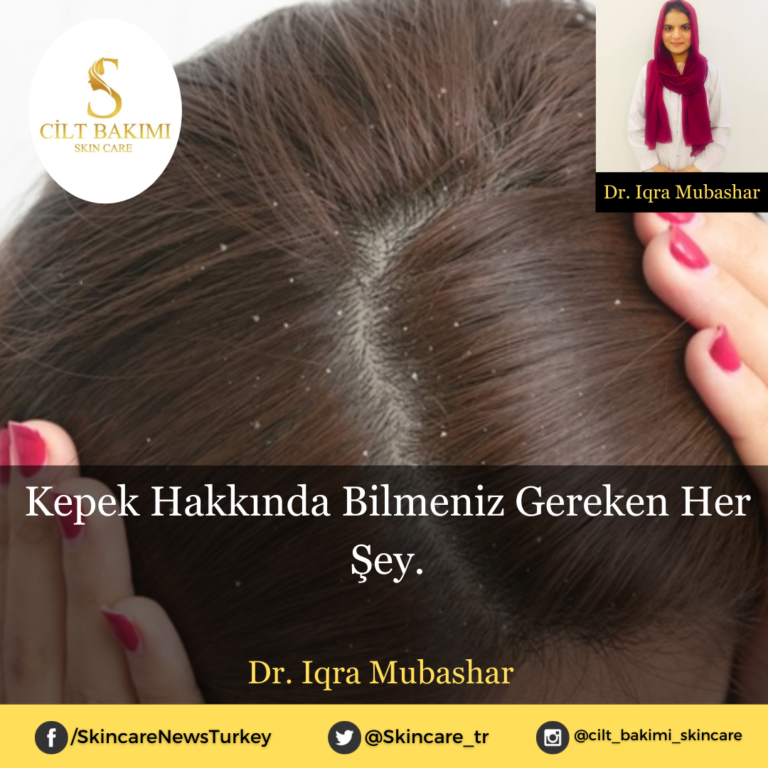 Kepek Hakkında Bilmeniz Gereken Her Şey.