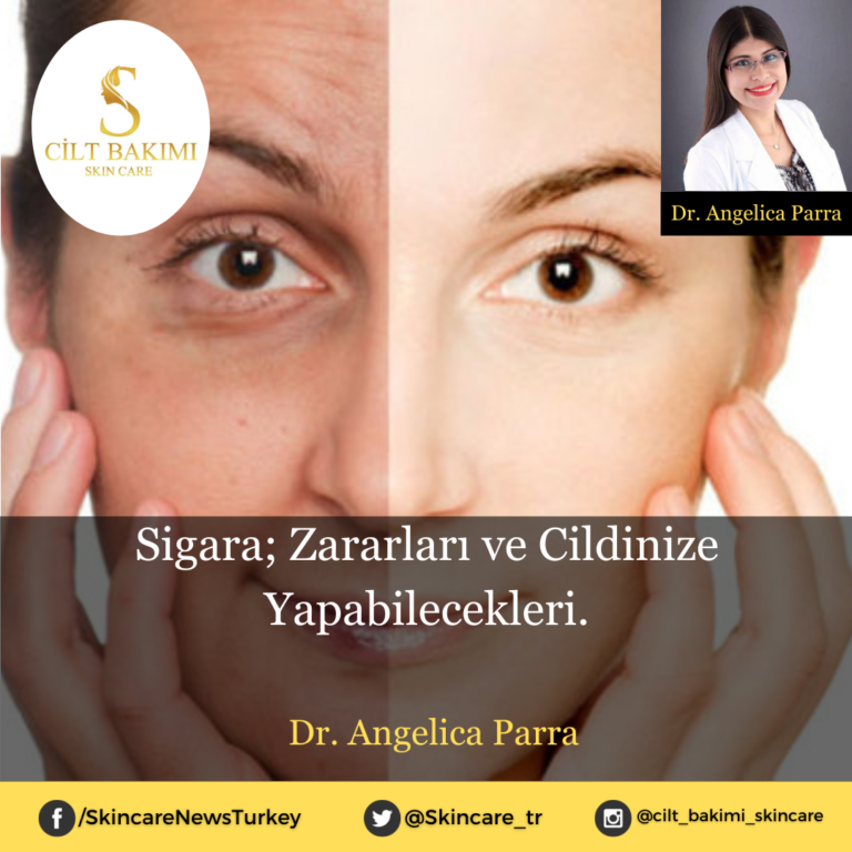 Sigara; Zararları ve Cildinize Yapabilecekleri.