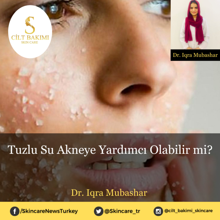 Tuzlu Su Akneye Yardımcı Olabilir mi?