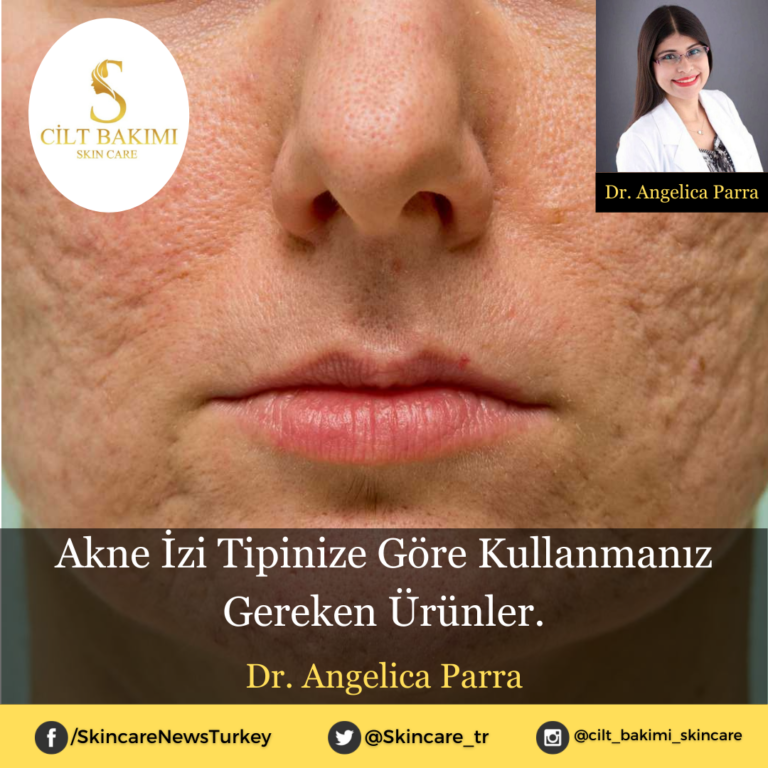 Akne İzi Tipinize Göre Kullanmanız Gereken Ürünler.