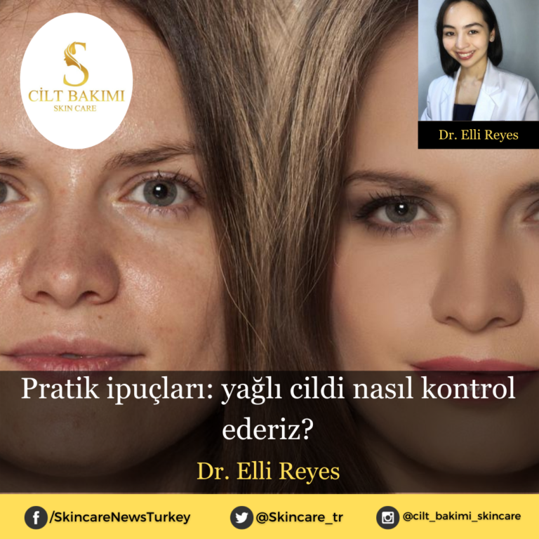 Pratik ipuçları: yağlı cildi nasıl kontrol ederiz?