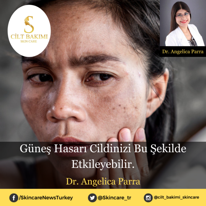 Skincare News v2 - Haziran Kopyası (22) güneş hasarı