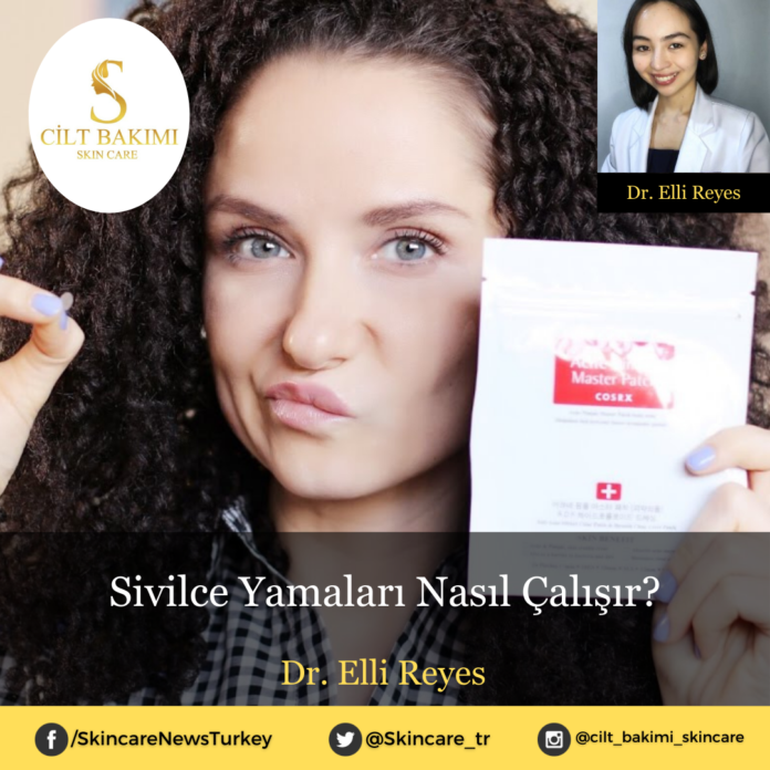 sivilce