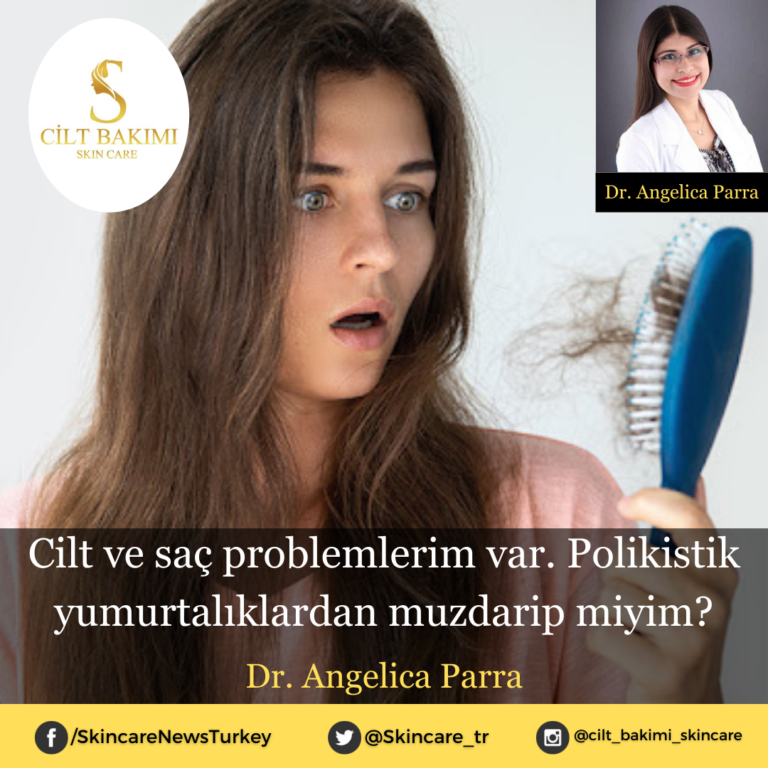 Cilt ve saç problemlerim var. Polikistik yumurtalıklardan (PKOS) muzdarip miyim?