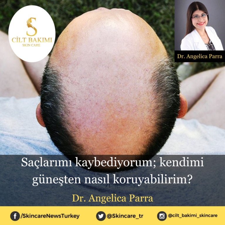 Saçlarımı kaybediyorum; kendimi güneşten nasıl koruyabilirim?