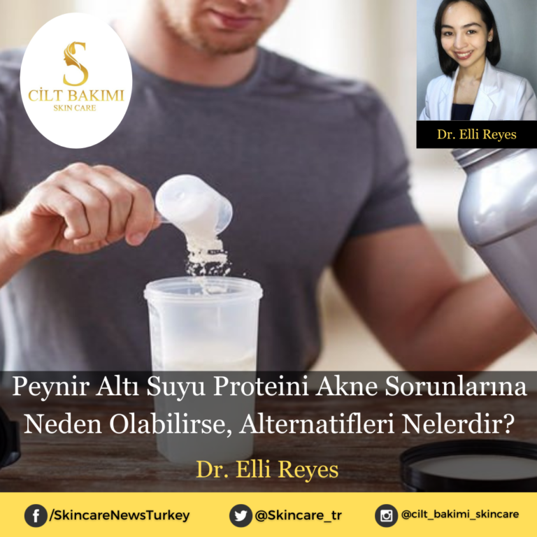 Peynir Altı Suyu Proteini Akne Sorunlarına Neden Olabilirse, Alternatifleri Nelerdir?