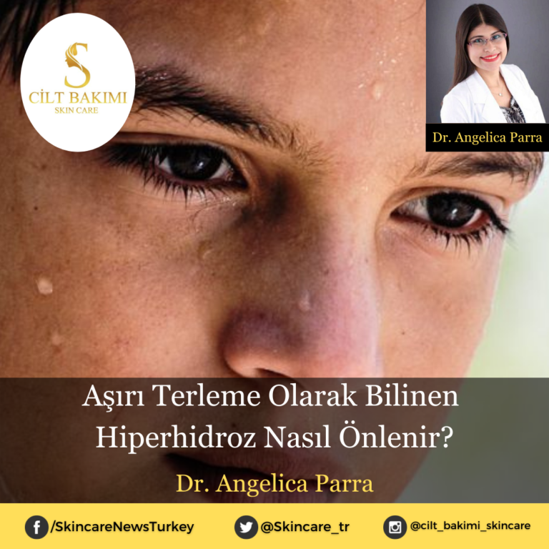Aşırı Terleme Olarak Bilinen Hiperhidroz Nasıl Önlenir?