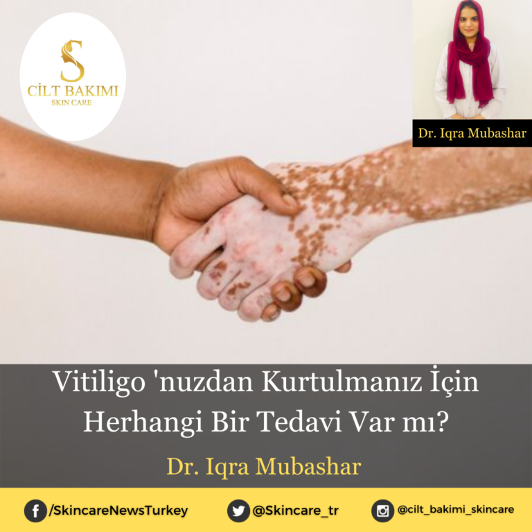 Vitiligo ‘nuzdan Kurtulmanız İçin Herhangi Bir Tedavi Var mı?