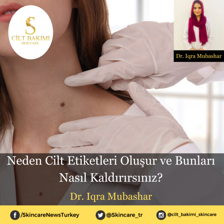 Neden Cilt Etiketleri Oluşur ve Bunları Nasıl Kaldırırsınız?