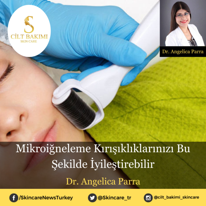 mikroiğneleme