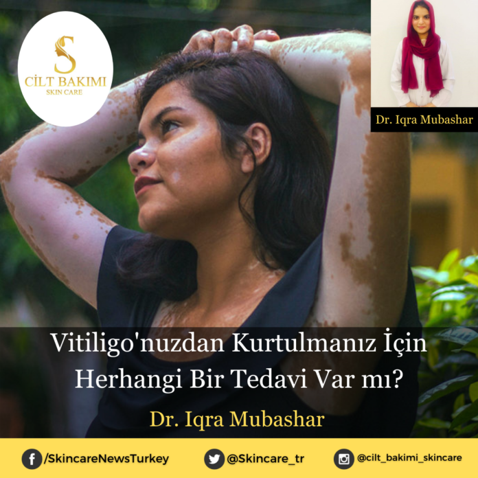 Skincare News v2 - Haziran Kopyası Kopyası (9) vitiligo'nuzdan kurtulmanız