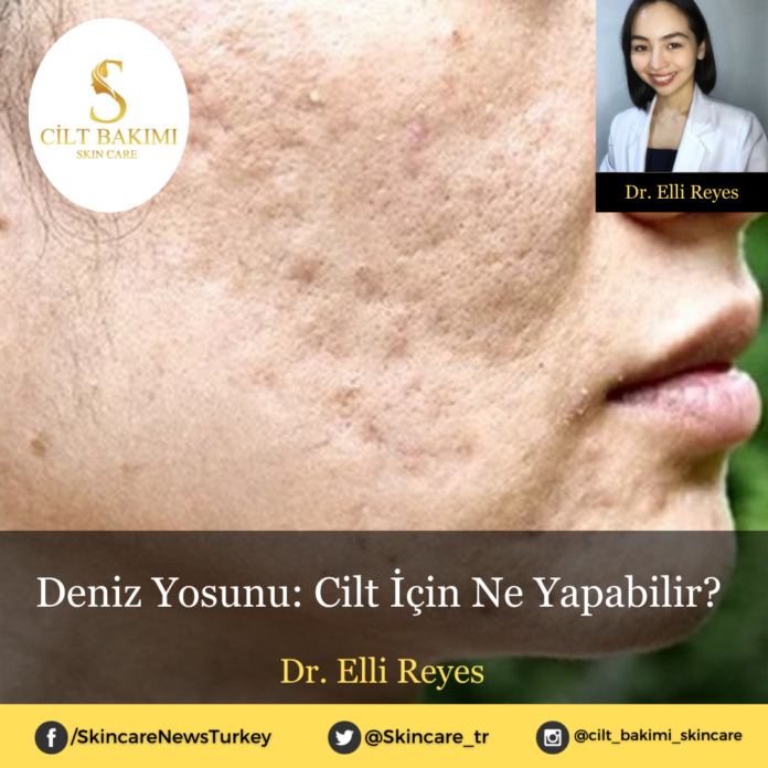 Skincare News v2 - Haziran Kopyası Kopyası (12) Deniz Yosunu