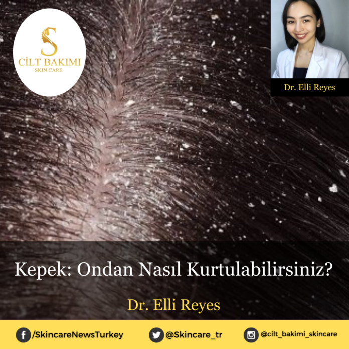 Skincare News v2 - Haziran Kopyası Kopyası kepek