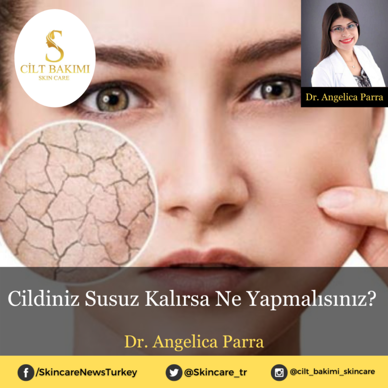 Cildiniz Susuz Kalırsa Ne Yapmalısınız?