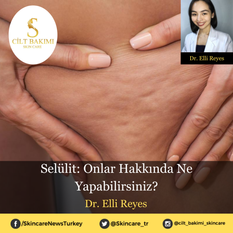 Selülit: Onlar Hakkında Ne Yapabilirsiniz?
