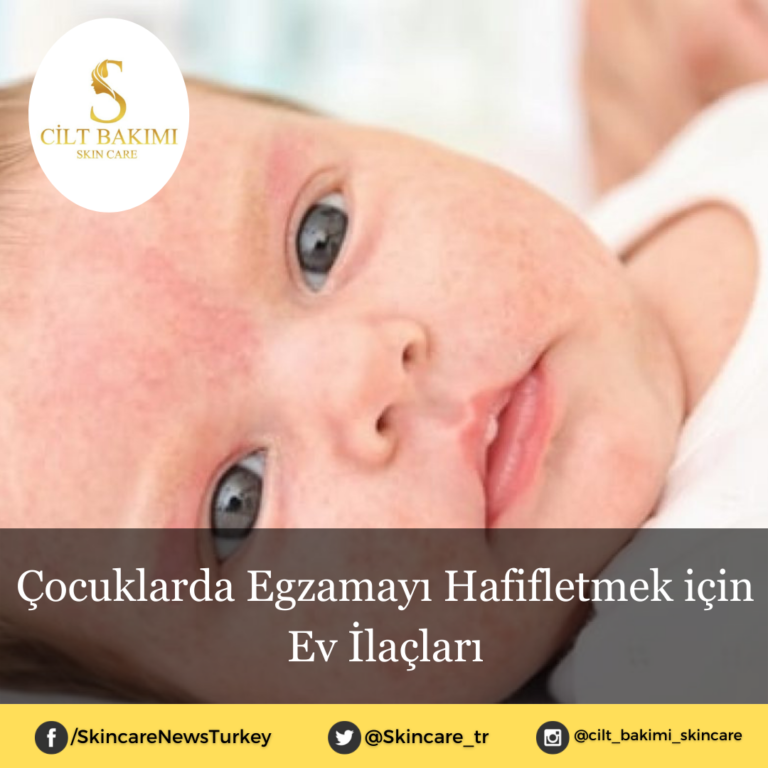 Çocuklarda Egzamayı Hafifletmek için Ev İlaçları