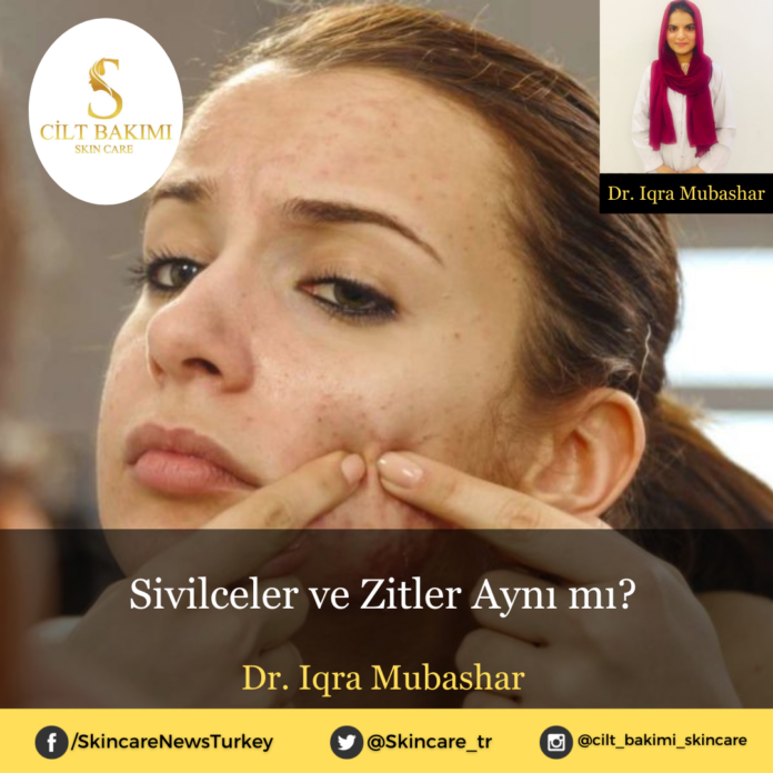 Skincare News v2 - Haziran Kopyası Kopyası (3) Sivilceler ve Zitler