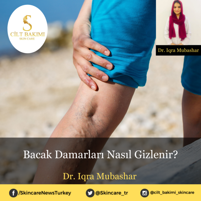 bacak damarları