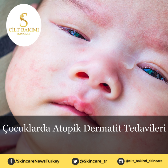 Skincare News v2 - Haziran Kopyası Kopyası (1) Atopik Dermatit