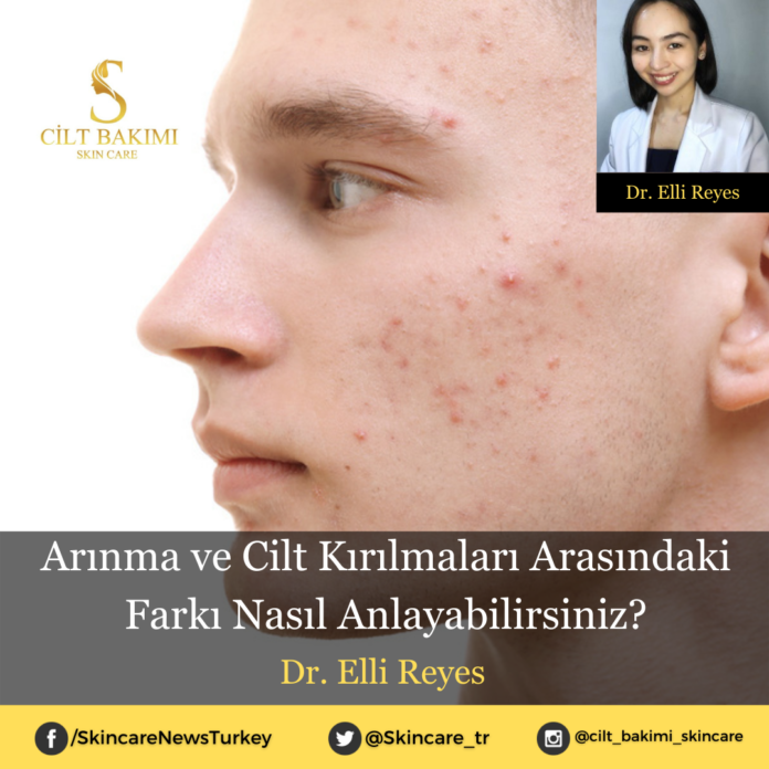Skincare News v2 - Haziran Kopyası Kopyası (1) Cilt Kırılmaları
