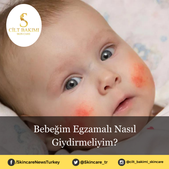 egzemalı