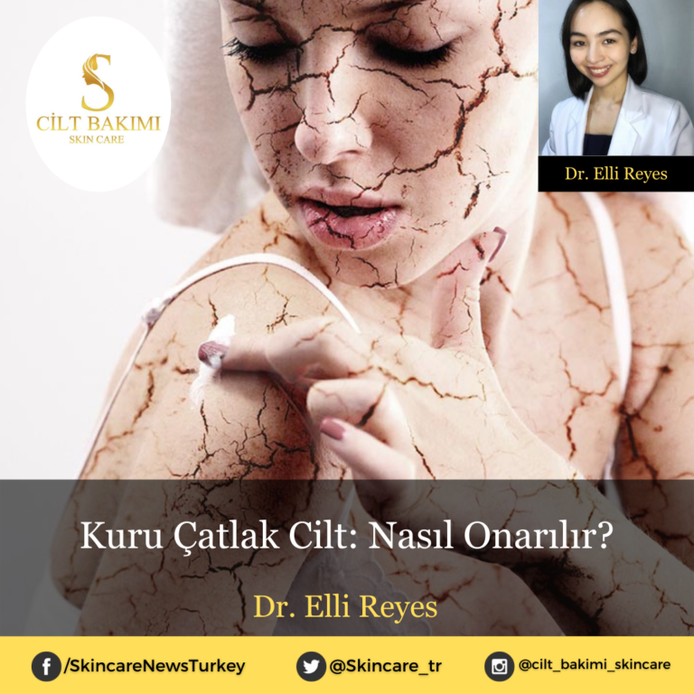 Kuru Çatlak Cilt: Nasıl Onarılır?