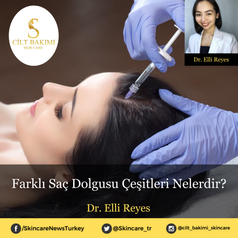 Farklı Saç Dolgusu Çeşitleri Nelerdir?