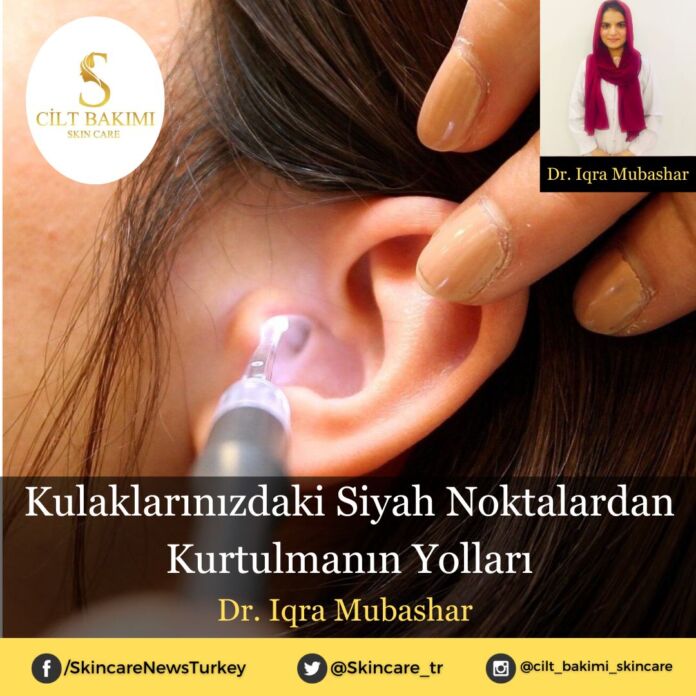 Skincare News v2 - Haziran Kopyası (9) Kulaklarınızdaki Siyah Noktalardan Kurtulmanın Yolları