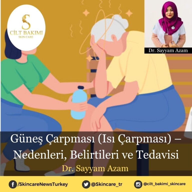 Güneş Çarpması (Isı Çarpması) – Nedenleri, Belirtileri ve Tedavisi