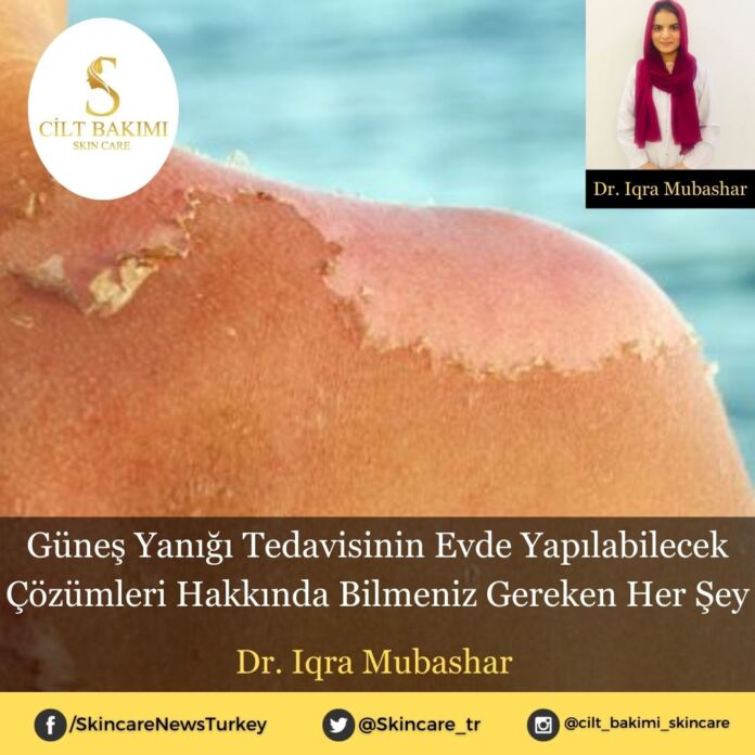 Skincare News v2 - Haziran Kopyası Güneş Yanığı Tedavisinin Evde Yapılabilecek Çözümleri Hakkında Bilmeniz Gereken Her Şey