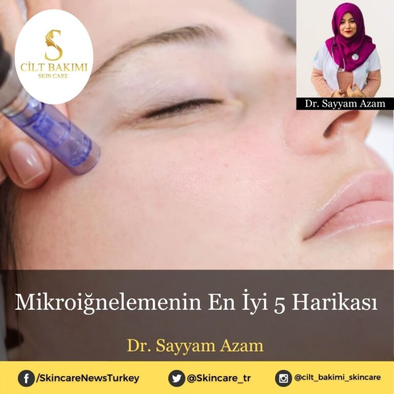 Mikroiğnelemenin En İyi 5 Harikası