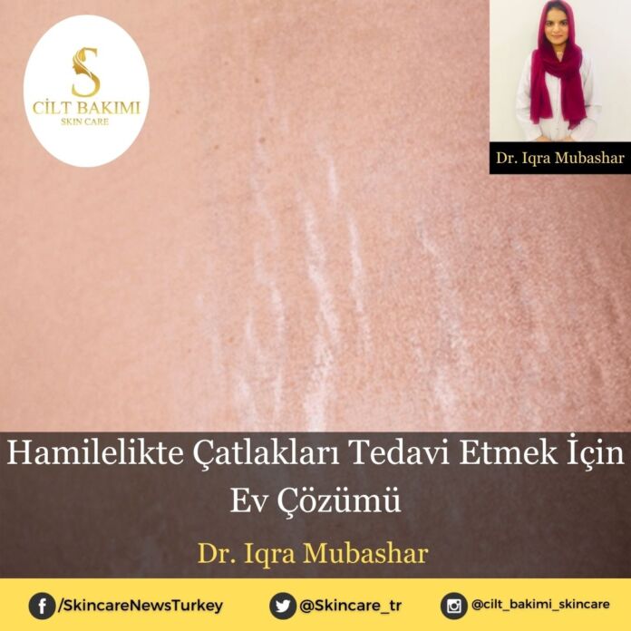 Skincare News v2 - Haziran Kopyası Hamilelikte Çatlakları Tedavi Etmek İçin Ev Çözümü