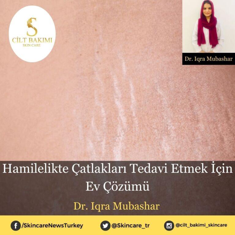 Hamilelikte Çatlakları Tedavi Etmek İçin Ev Çözümü
